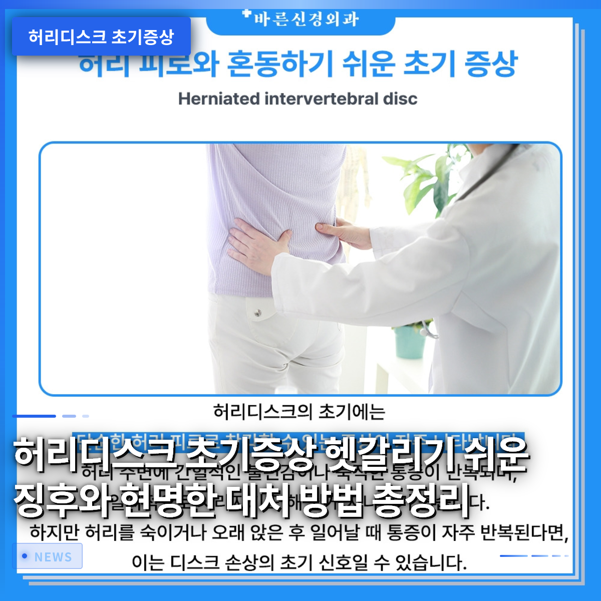腰椎ヘルニアの初期症状:見分けがつきにくいサインと賢い対処法の総まとめ 腰椎ヘルニアの初期症状:見分けがつきにくいサインと賢い対処法の総まとめ